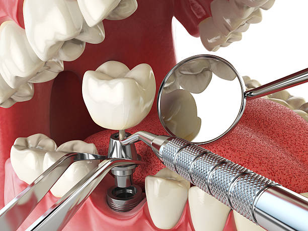 Best Emergency Tooth Extraction  in Riverwoods, IL